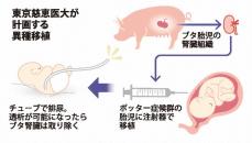 国内初の「異種移植」へ　ブタの腎組織を腎臓病の胎児に　慈恵医大