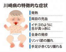 乳幼児かかる「川崎病」　暑さで発症リスク上昇　東京科学大チーム