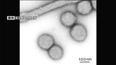 感染症情報　インフルエンザは6週ぶり減少　手足口病は2週ぶり増加で警報続く　鹿児島
