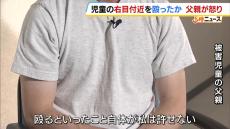 「血と涙が混じり流れていた」支援学級の児童の右目付近を殴った疑いで４６歳の担任教諭逮捕