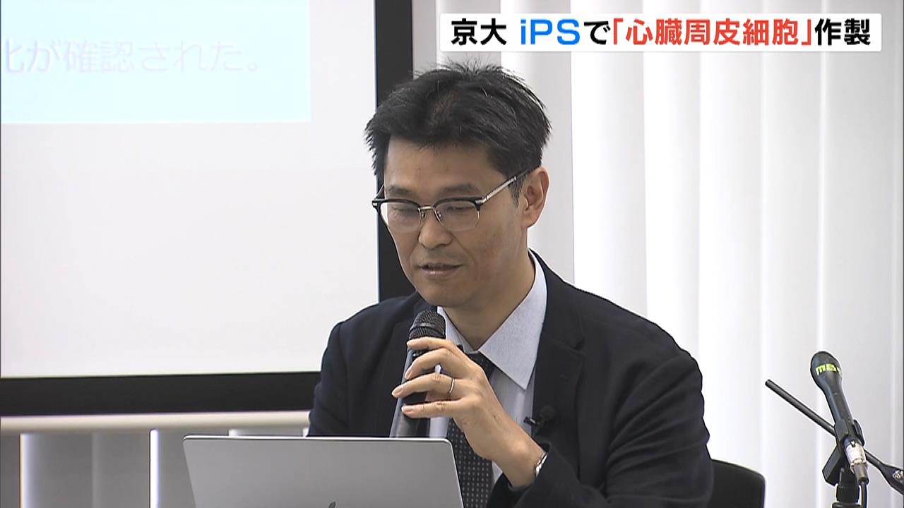 心不全の新たな治療の開発につながることが期待　ｉＰＳ細胞から心筋細胞の増殖促す「心臓周皮細胞」作製　京大などの研究グループ