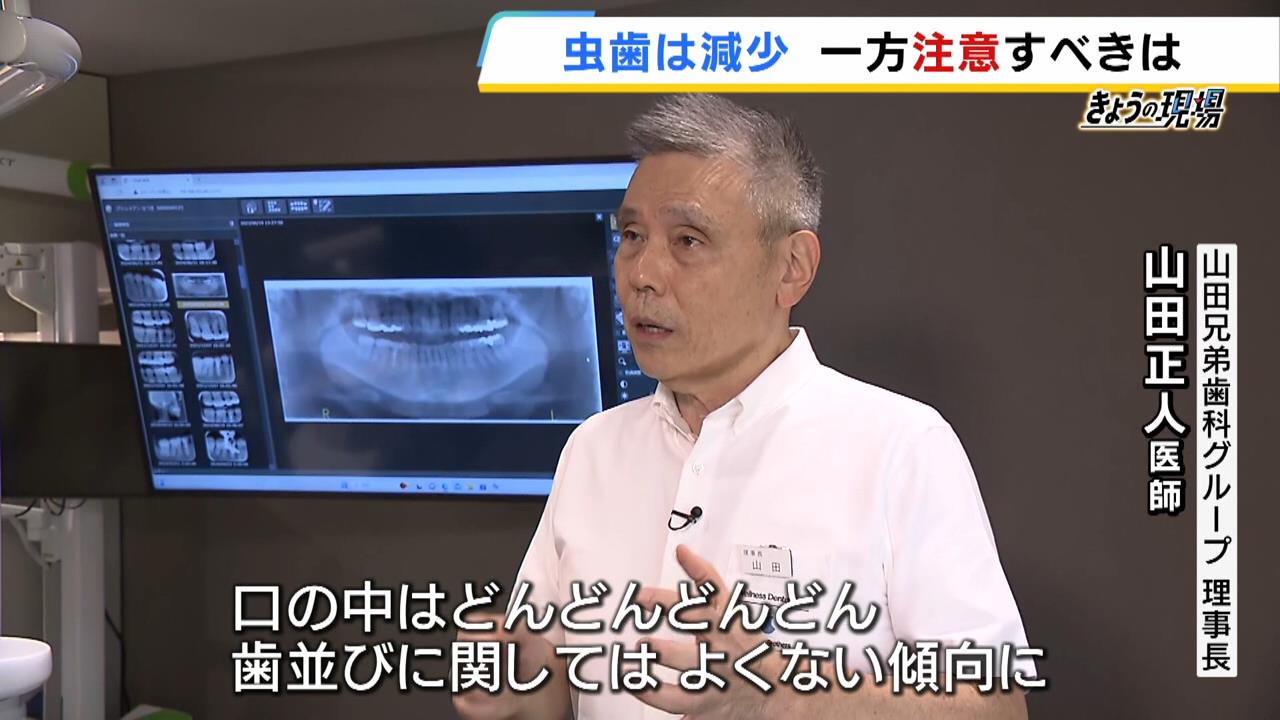 “虫歯の子ども”の割合が過去最少に！？「今の子らはしっかり歯磨きしている」　一方で歯科医は「歯並びはよくない傾向」と指摘するワケ