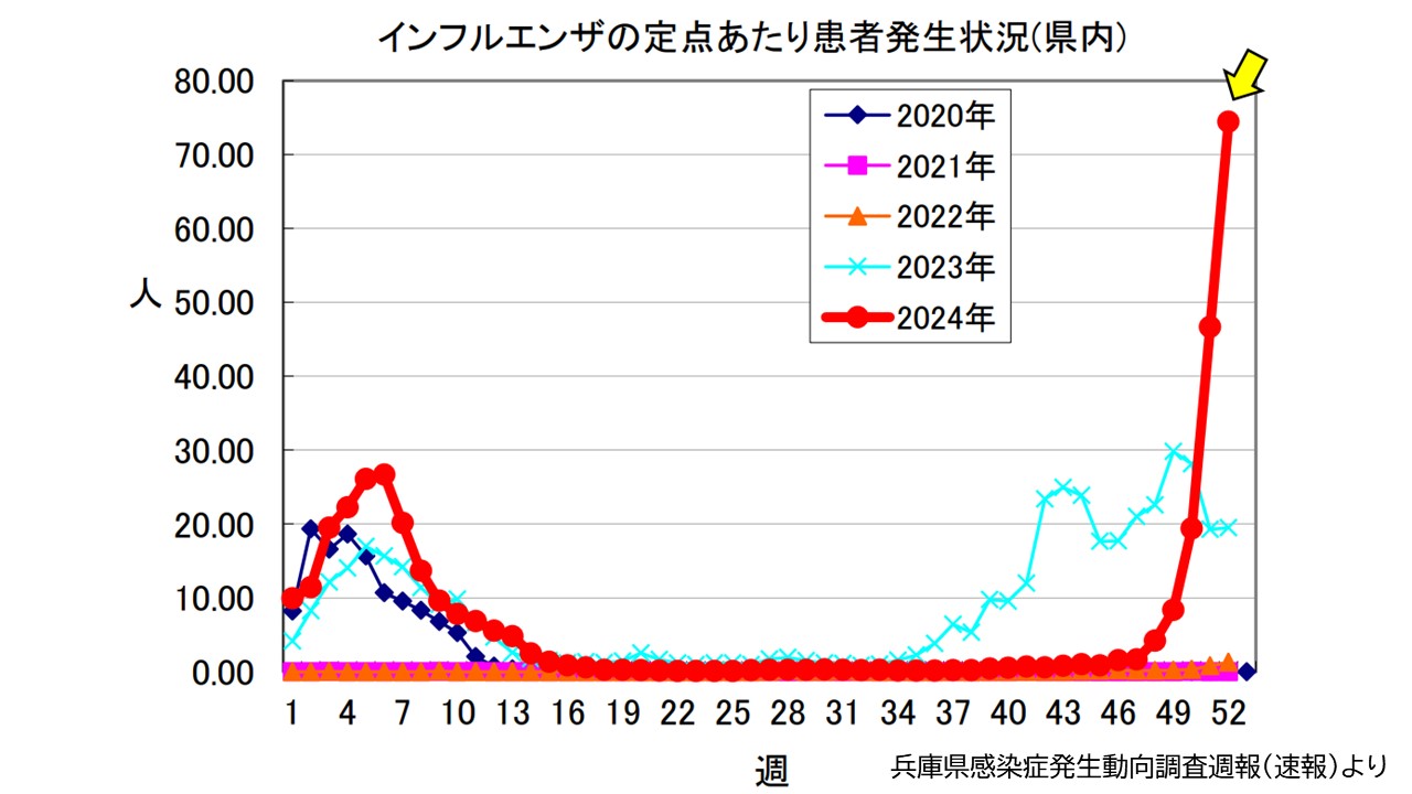 インフルエンザ過去１０年で最大の流行～兵庫県　医療機関あたり患者１００人超える地域も（明石市、加古川など）