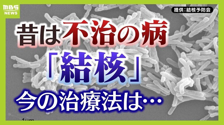 今も年間１万人以上が感染　せきや体のだるさが続いたら要注意？令和に知っておきたい『結核』の脅威と症状　発症のカギを握るのは「免疫力」