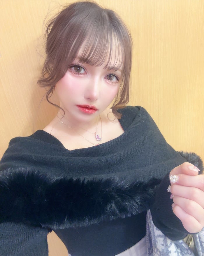 “顔全パーツ整形”現役アイドル・MiRichan、300万で脂肪吸引 術後の痛み・苦労明かす