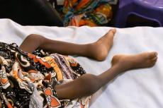 ナイジェリア：北部で重度栄養失調児が急増——医療施設はひっ迫