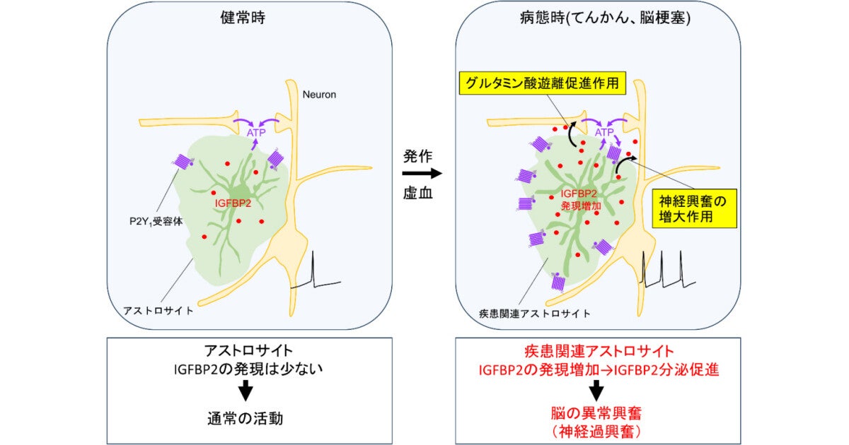 脳の異常興奮を引き起こすグリア物質「IGFBP2」、山梨大などが発見