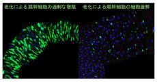 理研、老化すると組織幹細胞も疲弊することをハエから発見