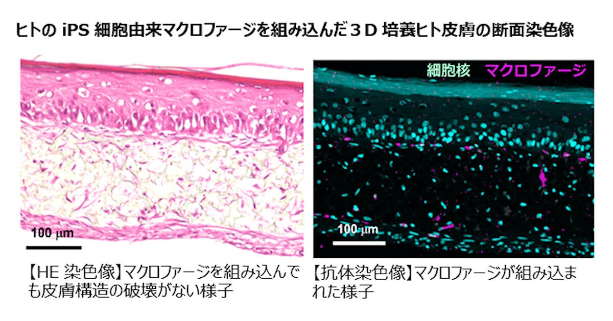 キリン、免疫細胞のマクロファージを組み込んだ3D培養ヒト皮膚モデルを開発