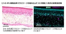 キリン、免疫細胞のマクロファージを組み込んだ3D培養ヒト皮膚モデルを開発