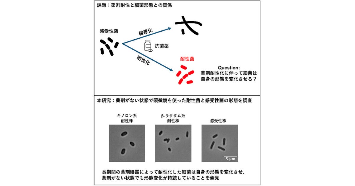 阪大、薬に強い菌に対して解析し細菌の形態と薬剤耐性の関連を解明