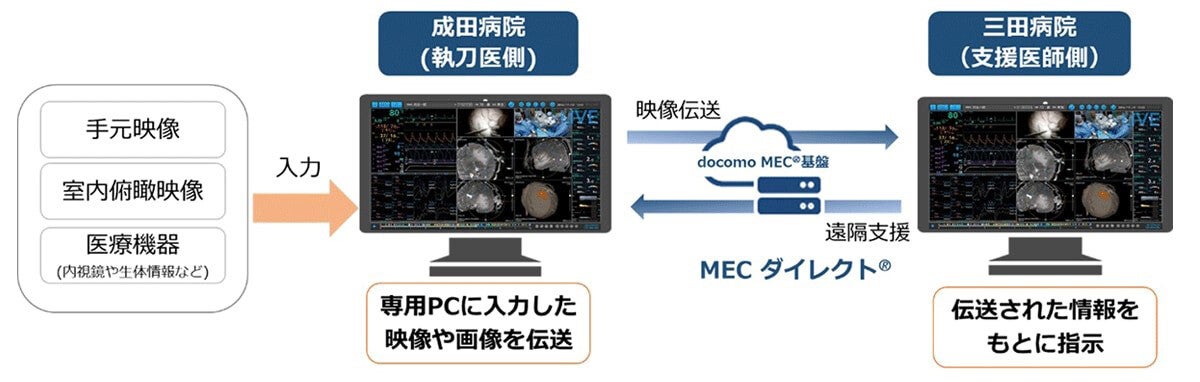 遠隔手術支援および手術映像の教育活用の実証実験に成功、NTT Comら