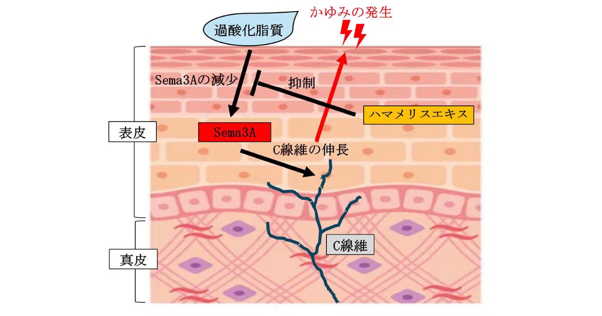 皮脂の酸化が頭皮のかゆみを引き起こすメカニズム、第一三共ヘルスケアが解明