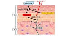 皮脂の酸化が頭皮のかゆみを引き起こすメカニズム、第一三共ヘルスケアが解明