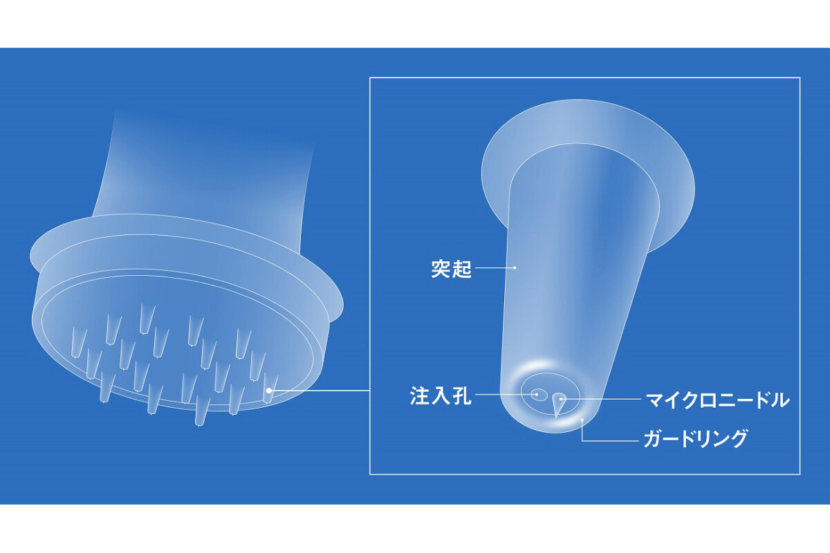 資生堂、注入と押圧の機能を備えた独自構造の次世代マイクロニードル開発