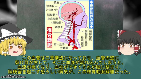 米誌の人気モデルが椎骨動脈損傷で急死　カイロプラクティックが原因で2016年に起きた事故を振り返る