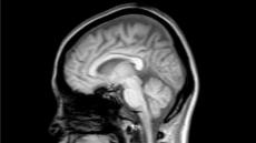 40歳を過ぎたら、5年に1度は「脳ドック」を受ける　～脳の病気を防ぐために