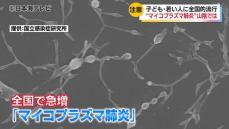 山陰地方でも10月に入り急増　マイコプラズマ肺炎に注意　症状やその対策とは？