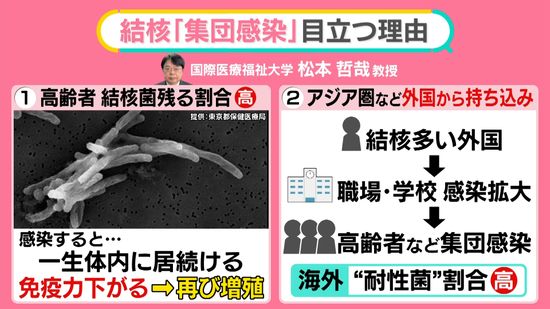 “昔の病気”ではない……「結核」で1500人超死亡、海外からの持ち込みで集団感染も　マイコプラズマも流行【#みんなのギモン】