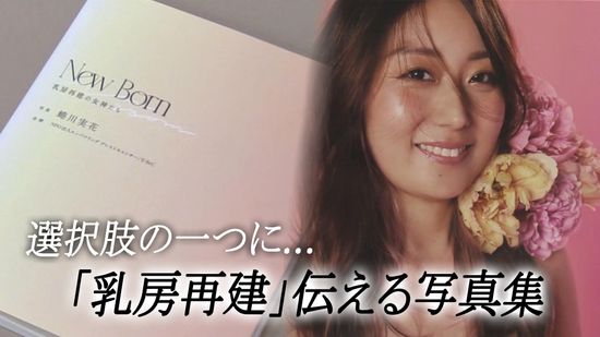 「まだまだ輝いていたい」選んだ乳房再建　がん手術後の“選択肢”を伝える12人の写真集　蜷川実花さんが撮影