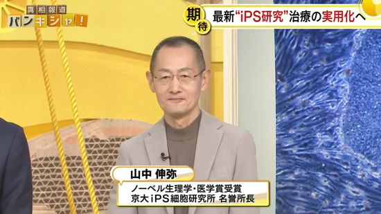 最新“iPS研究”で「がん治療」に新たな光？ 山中伸弥教授が解説【バンキシャ！】