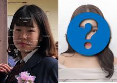 【整形美女】小学生時代のトラウマから顔面コンプレックスに…劇的な変貌を遂げた女性が、それでも「整形は魔法じゃない」と発信する意味