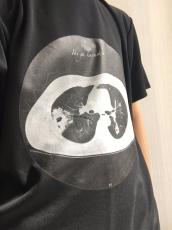 センス抜群！自分の肺の画像をプリントしてTシャツに