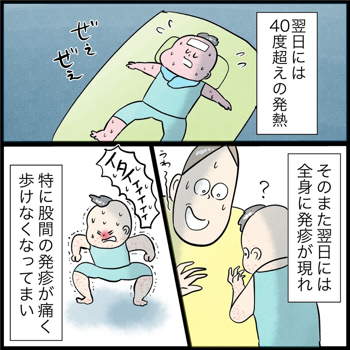 【漫画】次男が「手足口病」に　高熱＆発疹に悩まされる様子に「うちも大惨事でした」＜作者インタビュー＞