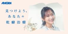 高島彩さんが乾癬疾患啓発活動のアンバサダーに　正しい理解を広めたいとアムジェンが起用