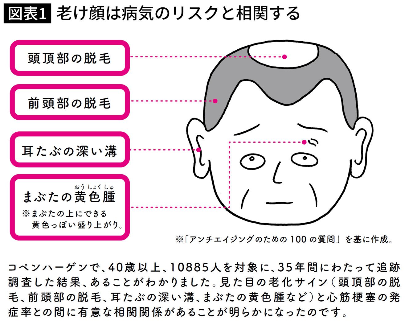 死亡率約2倍 心筋梗塞のリスク上昇 老け顔 の人は体の中身も老けている 記事詳細 Infoseekニュース