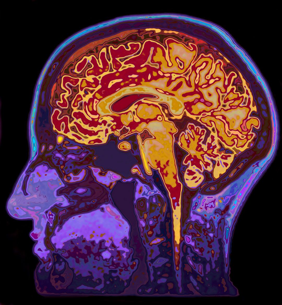 アルツハイマー病の予防は結局これに尽きる…脳の老廃物を手っ取り早く洗い流すための科学的な対策