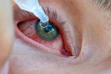 ｢雑菌入り目薬｣で失明､最悪の場合は死に至る…眼科医が警告する｢SNSで広がる手作り目薬｣の重大リスク