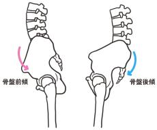 靴底を見れば｢姿勢の悪い人｣が一発でわかる…運動指導のプロが教える｢骨盤をゆがめる生活習慣｣