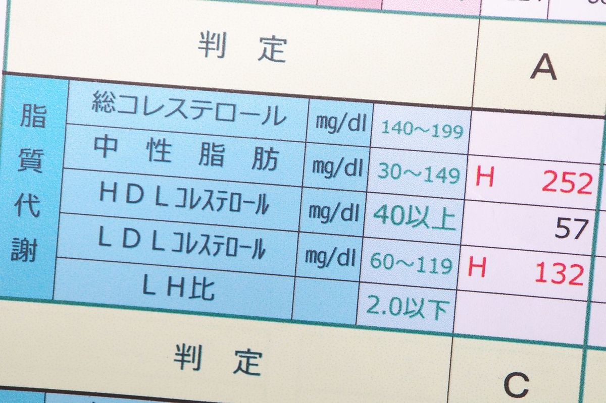 健康診断の数値はさほど意味がない…和田秀樹がそれでも｢中高年は受けるべき｣と説く&quot;2つの検査&quot;