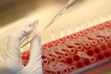 中国生物技術、コロナワクチン治験で抗体の生成確認