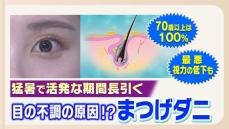 「目がゴロゴロする」原因は「まつ毛ダニ」かも　メイクの落とし忘れに要注意！