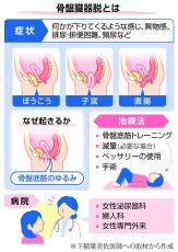 女性泌尿器の悩み、打ち明けて　看護師による相談会に記者が参加