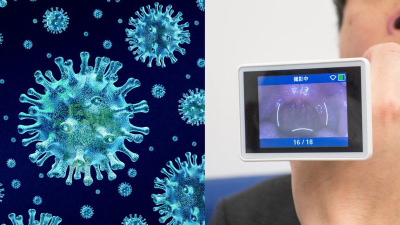 「痛みも少なく待ち時間も短い」インフルエンザ検査の革新的ハードウェアが実用化。日本初のAI新医療機器「nodoca」とは？