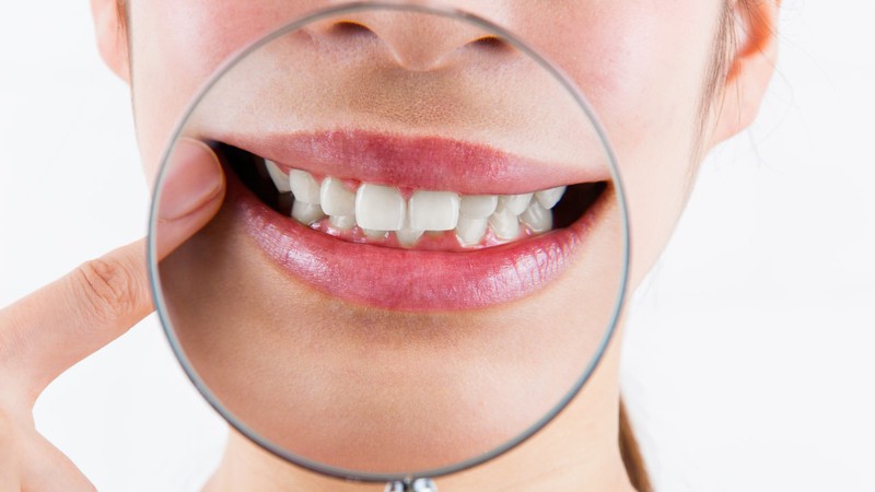 口を閉じているとき、無意識に奥歯が当たっていませんか？ 歯の天敵「TCH」の噛みグセが歯を失うリスクを増大させている！