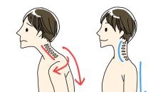 疲れがとれにくい、呼吸がしづらい、肩こりや頭痛がよくおきる…は「巻き肩」が原因だった！ スマホやPCを見る姿勢が体調を左右するつらい現実