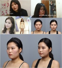 驚きの韓国整形手術、“老け顔”女性の新しい顔が美人過ぎ！！