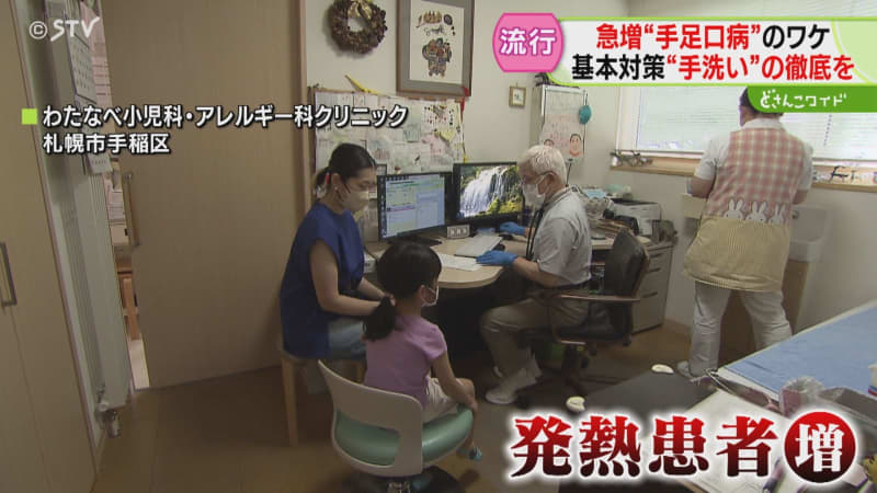 急増する子どもの夏風邪　手や足、口の中に発疹「手足口病」が警報レベルに　札幌市