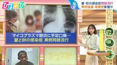 「マイコプラズマ肺炎」「手足口病」夏・秋の感染症が同時流行　「インフルエンザ」早めのワクチン接種を【ひるおび】