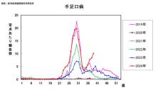 「手足口病」５週連続で増加　県が感染対策呼びかけ　患者数は同時期では直近５年で最多　《新潟》