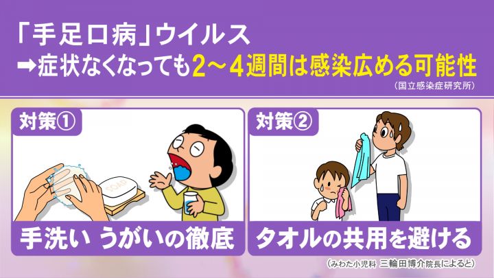 同じ子供が“何度もかかる”ケースも…『手足口病』が9-10月になって再流行 小児科医に聞いた特徴と対策