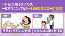 同じ子供が“何度もかかる”ケースも…『手足口病』が9-10月になって再流行 小児科医に聞いた特徴と対策