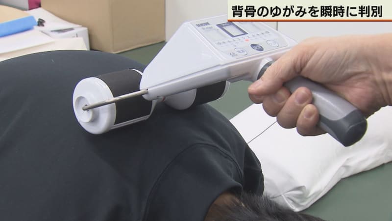 背骨のゆがみを簡単に検査　江別の企業が旭川医大と開発