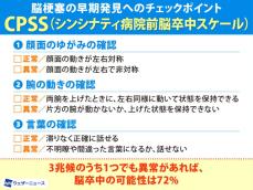 冬場に起こりやすい脳梗塞　早期発見へのチェックポイント