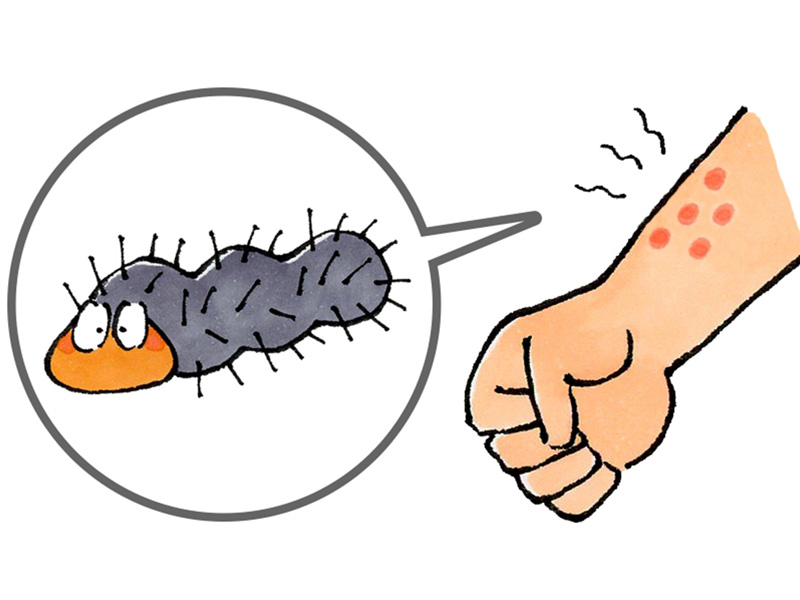 この時期に知っておきたい!毛虫に刺されたときの正しい対処法 ...