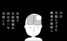 手術で前頭葉を切除　その後父におとずれた恐るべき後遺症とは？【若年性認知症の父親と私 Vol.4】